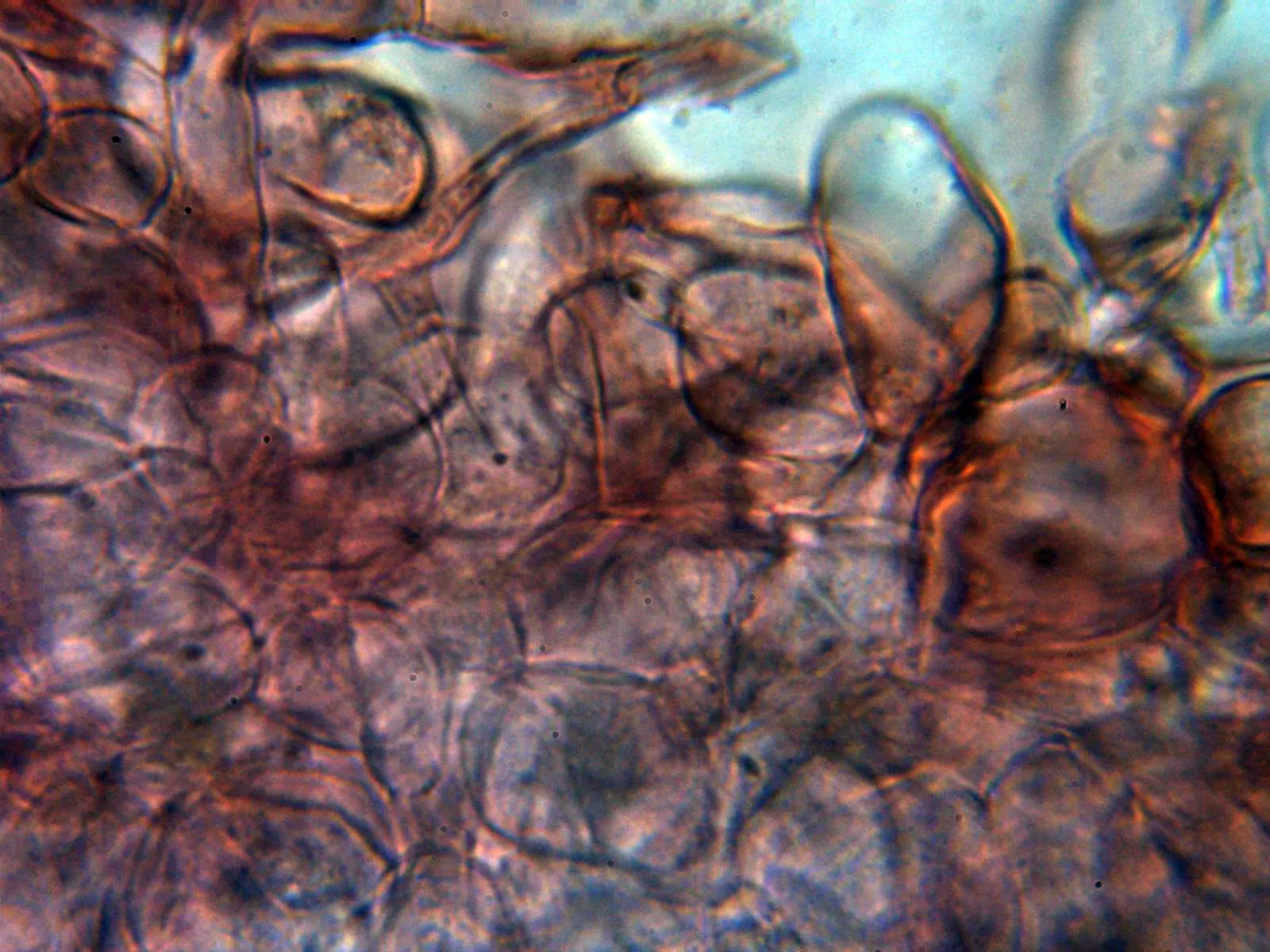 Microscopía de Bovistella utriformis - 10 - Endoperidio 1
